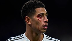 Militao chấn thương, Bellingham đổ máu, Real Madrid khủng hoảng